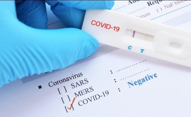 covid-19 test kit stock image